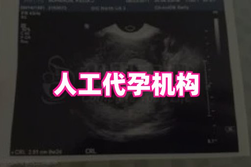 长春助孕网 4